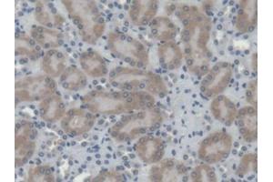 DAB staining on IHC-P; Samples: Mouse Kidney Tissue (Cathepsin H 抗体  (AA 21-333))