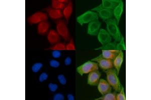 ABIN6258681 and ABIN6274241 staining Hela cells(45 min of heat-shock) by IF/ICC. (ACTN2/3 抗体  (N-Term))