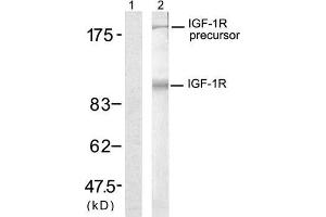 Western blot analysis of extract from 293 cells, using IGF-1R (Ab-1280) antibody (E021302, Lane 1 and 2). (IGF1R 抗体)