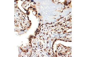 Immunohistochemistry of paraffin-embedded human placenta using CIRBP Rabbit mAb (ABIN7266452) at dilution of 1:100 (40x lens). (CIRBP 抗体)
