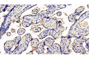 Detection of LIFR in Human Placenta Tissue using Polyclonal Antibody to Leukemia Inhibitory Factor Receptor (LIFR) (LIFR 抗体  (AA 692-833))