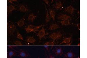 Immunofluorescence analysis of C6 cells using SLC25A24 Polyclonal Antibody at dilution of 1:100. (SLC25A24 抗体)