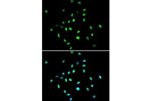 Immunofluorescence analysis of A549 cells using HDAC1 antibody. (HDAC1 抗体  (AA 393-482))