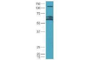Lane 1: mouse brain lysates probed with Rabbit Anti-Chrm3 Polyclonal Antibody, Unconjugated  at 1:5000 for 90 min at 37˚C. (CHRM3 抗体  (AA 481-589))