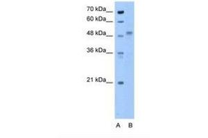 Image no. 1 for anti-Zona Pellucida Glycoprotein 4 (ZP4) (N-Term) antibody (ABIN6738590) (ZP4 抗体  (N-Term))