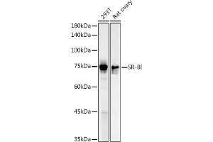 Western blot analysis of extracts of various cell lines, using SR-BI antibody (ABIN3022185, ABIN3022186, ABIN1513498 and ABIN6218655) at 1:1000 dilution. (SCARB1 抗体  (AA 1-100))