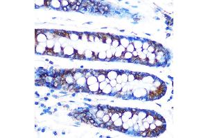 Immunohistochemistry of paraffin-embedded human colon using Lumican (LUM) (LUM) Rabbit mAb (ABIN7268309) at dilution of 1:100 (40x lens). (LUM 抗体)