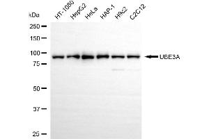 Western blotting analysis using UBE3A antibody (ABIN7800723).