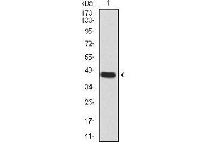 Western blot analysis using Rab13 mAb against human Rab13 (AA: 66-200) recombinant protein. (RAB13 抗体  (AA 66-200))