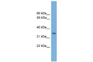 WB Suggested Anti-Nkx3-2 Antibody Titration:  0. (NKX3-2 抗体  (Middle Region))