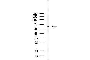 anti-Cholinergic Receptor, Nicotinic, epsilon (Muscle) (CHRNE) antibody