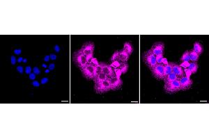 Immunocytochemical staining of HT- cells with NPC1 antibody (ABIN7799598), 1:1,000).