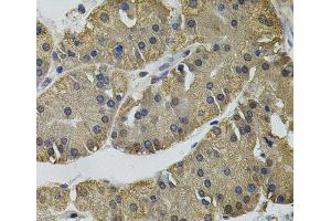 Immunohistochemistry of paraffin-embedded Human stomach using IL33 Polyclonal Antibody (IL-33 抗体)