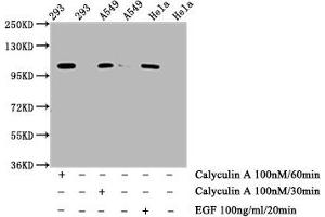 Western Blot  Positive WB detected in: 293 whole cell lysate, A549 whole cell lysate, Hela whole cell lysate (treated with Calyculin A or EGF)  All lanes: Phospho-ERN1 antibody at 0. (Recombinant ERN1 抗体  (pSer724))