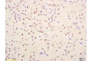 Formalin-fixed and paraffin embedded rat brain labeled with Rabbit Anti PRKAG2/AMPK? (AMPK gamma 1/2/3 (AA 280-330) 抗体)