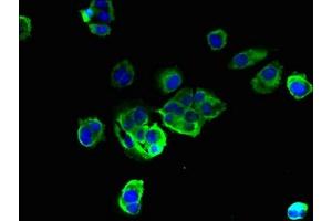 Immunofluorescent analysis of MCF-7 cells using ABIN7173183 at dilution of 1:100 and Alexa Fluor 488-congugated AffiniPure Goat Anti-Rabbit IgG(H+L) (TMEM256 抗体  (AA 30-63))