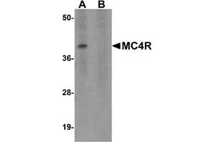 Western Blotting (WB) image for anti-Melanocortin 4 Receptor (MC4R) (N-Term) antibody (ABIN1031454) (MC4R 抗体  (N-Term))