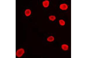 Immunofluorescent analysis of Histone Deacetylase 9 staining in Ramos cells. (HDAC9 抗体  (C-Term))