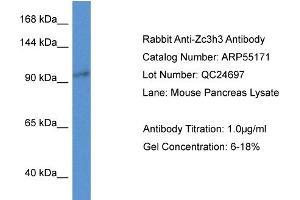 Western Blotting (WB) image for anti-Zinc Finger CCCH-Type Containing 3 (ZC3H3) (N-Term) antibody (ABIN2786081) (ZC3H3 抗体  (N-Term))