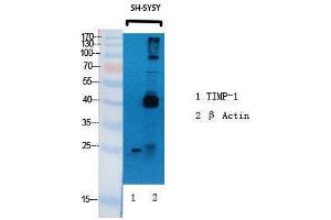 Western Blotting (WB) image for anti-TIMP Metallopeptidase Inhibitor 1 (TIMP1) (Internal Region) antibody (ABIN3187268) (TIMP1 抗体  (Internal Region))