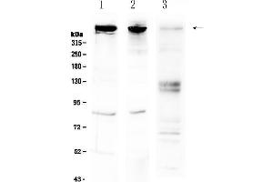 Western blot analysis of Sacsin using anti-Sacsin antibody . (Sacsin 抗体  (AA 3709-3909))