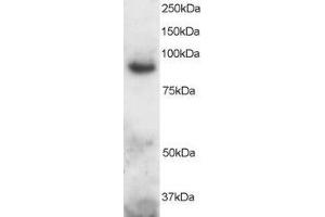 ABIN184726 staining (2µg/ml) of Human Brain lysate (RIPA buffer, 30µg total protein per lane). (ADAM8 抗体  (C-Term))