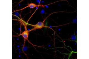 Immunofluorescence labeling of PFA fixed rat hippocampus neurons with β3-tubulin (dilution 1 : 500; red) and mouse anti-MAP 2 (cat. (TUBB3 抗体)