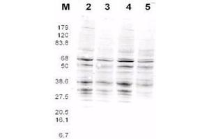 This product was assayed by western blotting against RFA2 containing cell lysates. (RPA2 抗体  (AA 115-129))