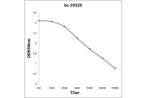 ELISA image for anti-ATG7 Autophagy Related 7 (ATG7) (AA 21-120) antibody (ABIN740190)