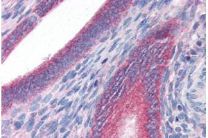 Human Uterus (formalin-fixed, paraffin-embedded) stained with DRAM antibody ABIN351448 at 3 ug/ml followed by biotinylated goat anti-rabbit IgG secondary antibody ABIN481713, alkaline phosphatase-streptavidin and chromogen. (DRAM 抗体  (C-Term))