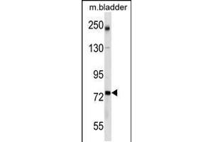 Western blot analysis in mouse bladder tissue lysates (35ug/lane). (GCLC 抗体  (AA 286-315))