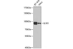 Western blot analysis of extracts of various cell lines using IL1R1 Polyclonal Antibody at dilution of 1:1000. (IL1R1 抗体)