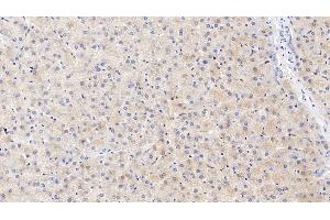 Detection of ITIH4 in Human Liver Tissue using Polyclonal Antibody to Inter Alpha-Globulin Inhibitor H4 (ITIH4) (ITIH4 抗体  (AA 683-928))