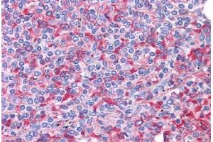 Immunohistochemistry (Formalin-fixed Paraffin-embedded Sections) (IHC (fp)) image for anti-SRY (Sex Determining Region Y)-Box 2 (SOX2) (N-Term) antibody (ABIN6745703)