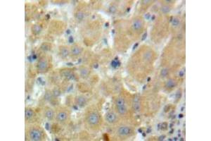 Used in DAB staining on fromalin fixed paraffin-embedded Liver tissue (Factor XI 抗体  (AA 170-398))