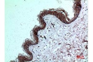 Immunohistochemistry (IHC) analysis of paraffin-embedded Human Skin, antibody was diluted at 1:100. (IL-8 抗体  (C-Term))