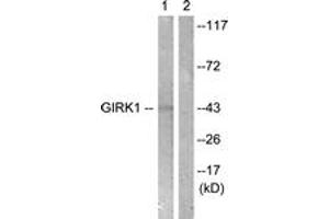Western blot analysis of extracts from NIH-3T3 cells, using GIRK1/KIR3. (KCNJ3 抗体  (AA 151-200))