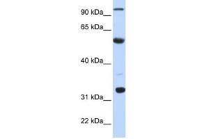 ApoBEC1 antibody used at 1 ug/ml to detect target protein. (APOBEC1 抗体  (N-Term))