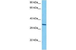 Host:  Mouse  Target Name:  ANXA5  Sample Tissue:  Mouse Brain  Antibody Dilution:  1ug/ml (Annexin V 抗体  (N-Term))