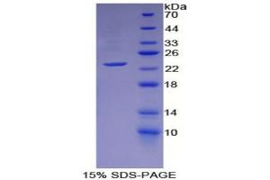 SDS-PAGE analysis of Mouse TNNI1 Protein.