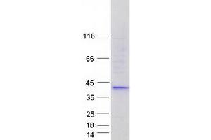 Western Blotting (WB) image for Filamin Binding LIM Protein 1 (FBLIM1) (Transcript Variant 3) protein (Myc-DYKDDDDK Tag) (ABIN2720917)