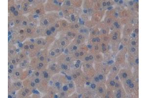 Immunohistochemistry (IHC) image for anti-Protease, serine, 2 (Trypsin 2) (PRSS2) (AA 29-240) antibody (ABIN7441880)