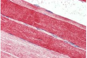 Immunohistochemistry (Formalin-fixed Paraffin-embedded Sections) (IHC (fp)) image for anti-Fatty Acid Binding Protein 7, Brain (FABP7) (AA 101-111) antibody (ABIN574099)
