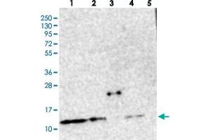 Western blot analysis of Lane 1: RT-4, Lane 2: U-251 MG, Lane 3: Human Plasma, Lane 4: Liver, Lane 5: Tonsil with CHCHD5 polyclonal antibody  at 1:250-1:500 dilution. (CHCHD5 抗体)