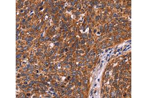 Immunohistochemistry (IHC) image for anti-Coiled-Coil Domain Containing 106 (CCDC106) antibody (ABIN2423069) (CCDC106 抗体)