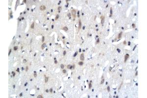 Formalin-fixed and paraffin embedded rat brain tissue labeled with Anti-PKC epsilon Polyclonal Antibody, Unconjugated (ABIN679538) followed by conjugation to the secondary antibody (PKC epsilon 抗体  (AA 631-737))