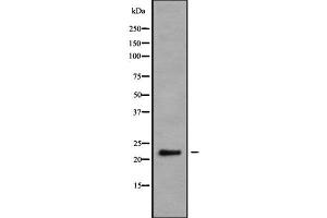 Western blot analysis NRSN2 using K562 whole cell lysates (NRSN2 抗体  (C-Term))
