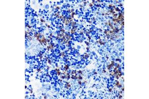 Immunohistochemistry of paraffin-embedded rat spleen using S100 Rabbit mAb (ABIN7270128) at dilution of 1:100 (40x lens). (S100A8 抗体)