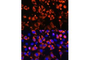 Immunofluorescence analysis of L929 cells using B9D1 Rabbit pAb (ABIN6133363, ABIN6137409, ABIN6137410 and ABIN6223982) at dilution of 1:100. (B9D1 抗体  (AA 1-130))