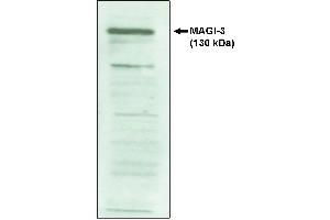 Western blot analysis using MAGI-3, PDZ 4-5 antibody on cell lysates transfected with  full-length human MAGI-3 protein. (MAGI (PDZ 4-5) 抗体)